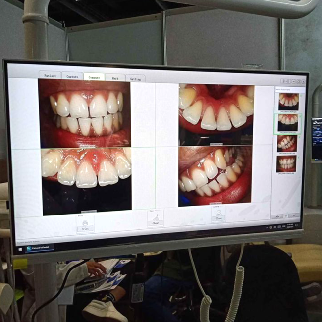 Dentalisches WLAN All-in-One-Intraorale Camera mit 24-Zoll-Touchscreen